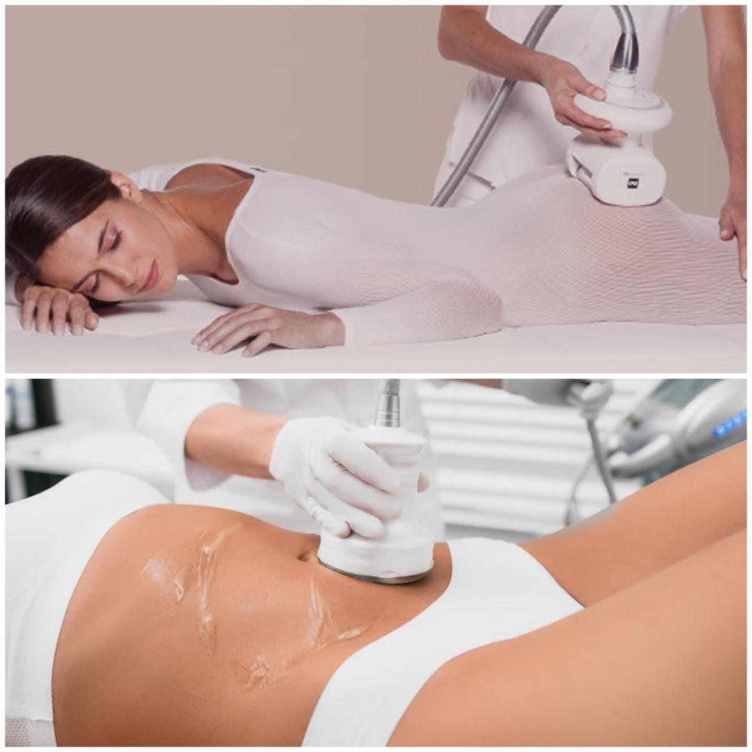 Forfait 5 séances de lipocavitation 1h + 5 séances de cellu M6 40 minutes