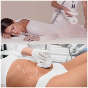 Forfait 5 Séances de Lipocavitation 1H + 5 séances de Cellu M6 40 minutes