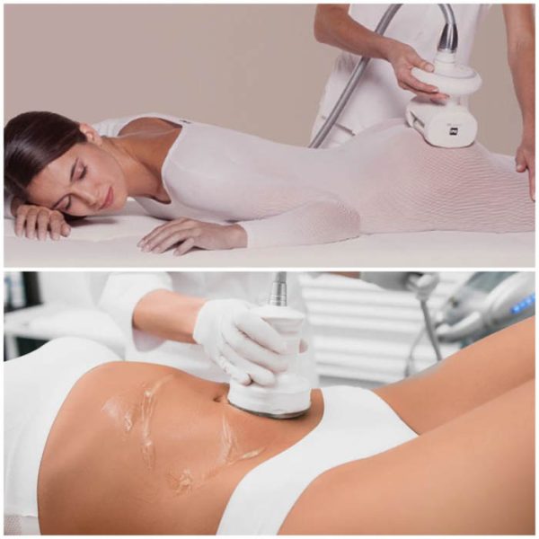 Forfait 5 séances de lipocavitation 1h + 5 séances de cellu M6 40 minutes