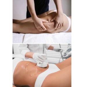 Forfait 5 séances lipocavitation + 5 séances de palper rouler 1h