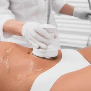 Forfait Lipocavitation 10 séances dont 1 offerte