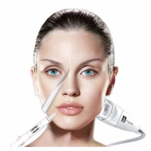 Peeling rénovateur LPG peau neuve 1h