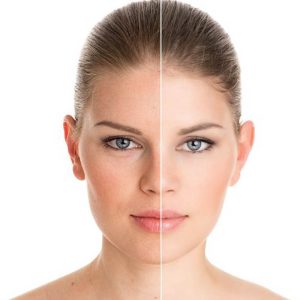 Le Be Glow visage & cou