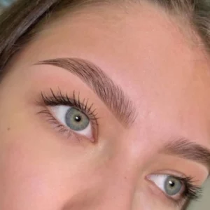 Brow lift ( Rehaussement des sourcils)